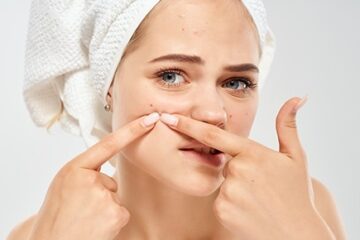 Tratamiento para el acné